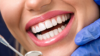 Closeup of smile with flawless tooth-colored fillings