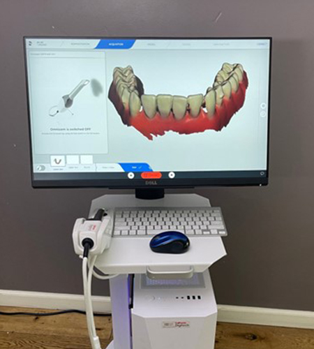 Dental restoration design with the CEREC system