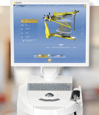 CEREC dental restoration design on computer monitor