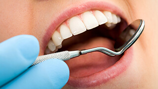 Closeup of smile during oral health exam
