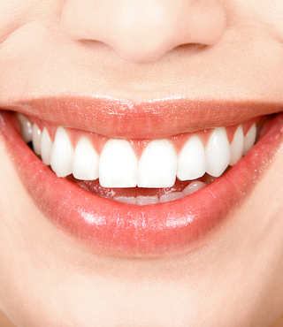 Woman with healthy happy smile