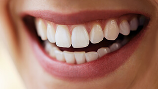 Closeup of flawless smile following porcelain veneer placement