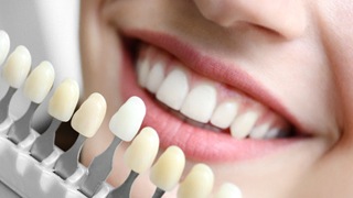 Color-matching teeth for cosmetic dentistry in Lakeville, MA