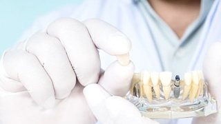 Lakeville implant dentist holding restoration and model dental implant