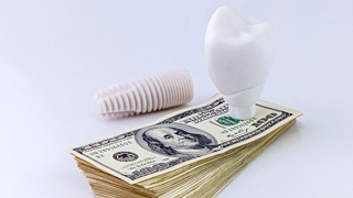 Model implant and stack of money symbolizing the cost of dental implants in Lakeville