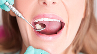 Closeup of smile during dental exam