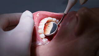 Closeup of healthy smile following gum disease treatment