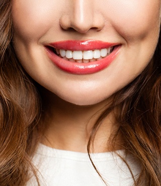 woman’s beautiful smile after using SureSmile Aligners in Lakeville