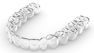 Single SureSmile aligner against neutral gray and white background