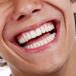 close-up of a healthy smile