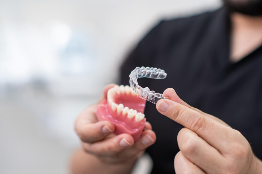 clear aligners