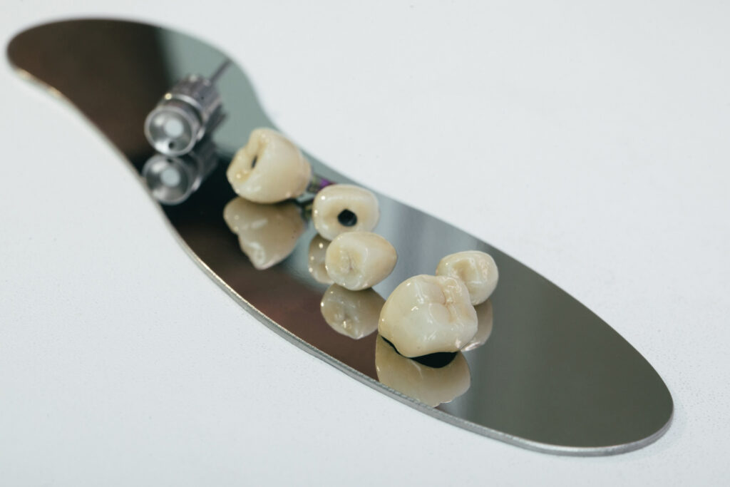 dental crown